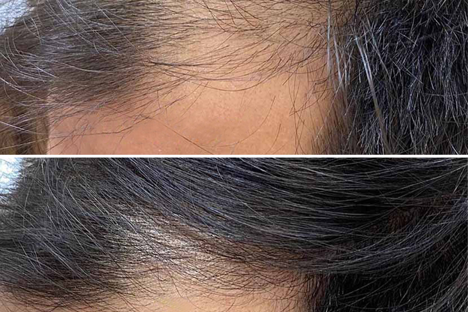 PhiLings-Behandlung, durchgeführt von Master Associate Saba Barati PhiLings-Behandlung, durchgeführt von Master Associate Saba Barati