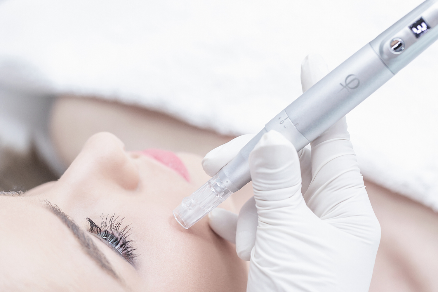 Microneedling-Verfahren mit Dermapen Microneedling-Verfahren mit Dermapen