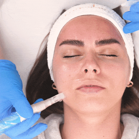 A microneedling treatment on a woman A microneedling treatment on a woman